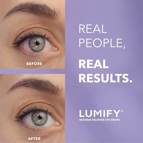 Lumify Redness Relief Eye Drops – Whiter & Brighter Looking Eyes 0.08 oz – view 2