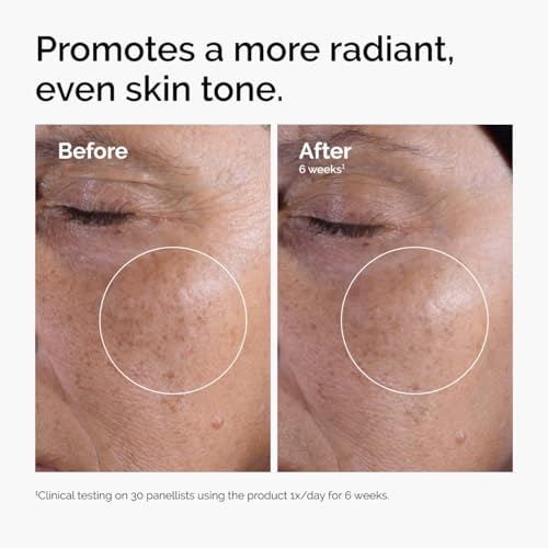 The Ordinary Glycolic Acid 7% Exfoliating Toner – Brightening & Smoothing Skincare – view 2